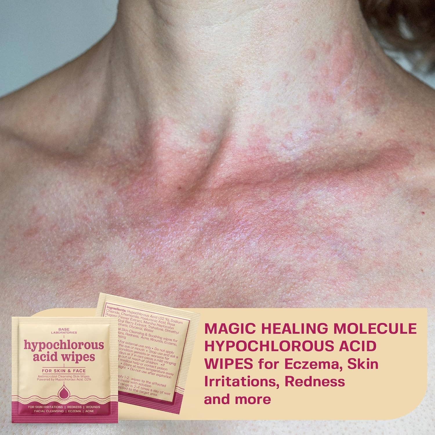 Hypochlorous Acid Facial Wipes - Wound Cleaning Wipes 75 count