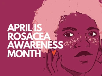 APRIL IS ROSACEA AWARENESS MONTH