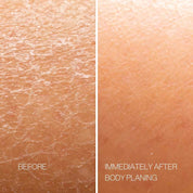 Body Plane Exfoliation Tool Set