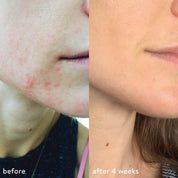 Miracle Mist with Hypochlorous Acid + Oxygen