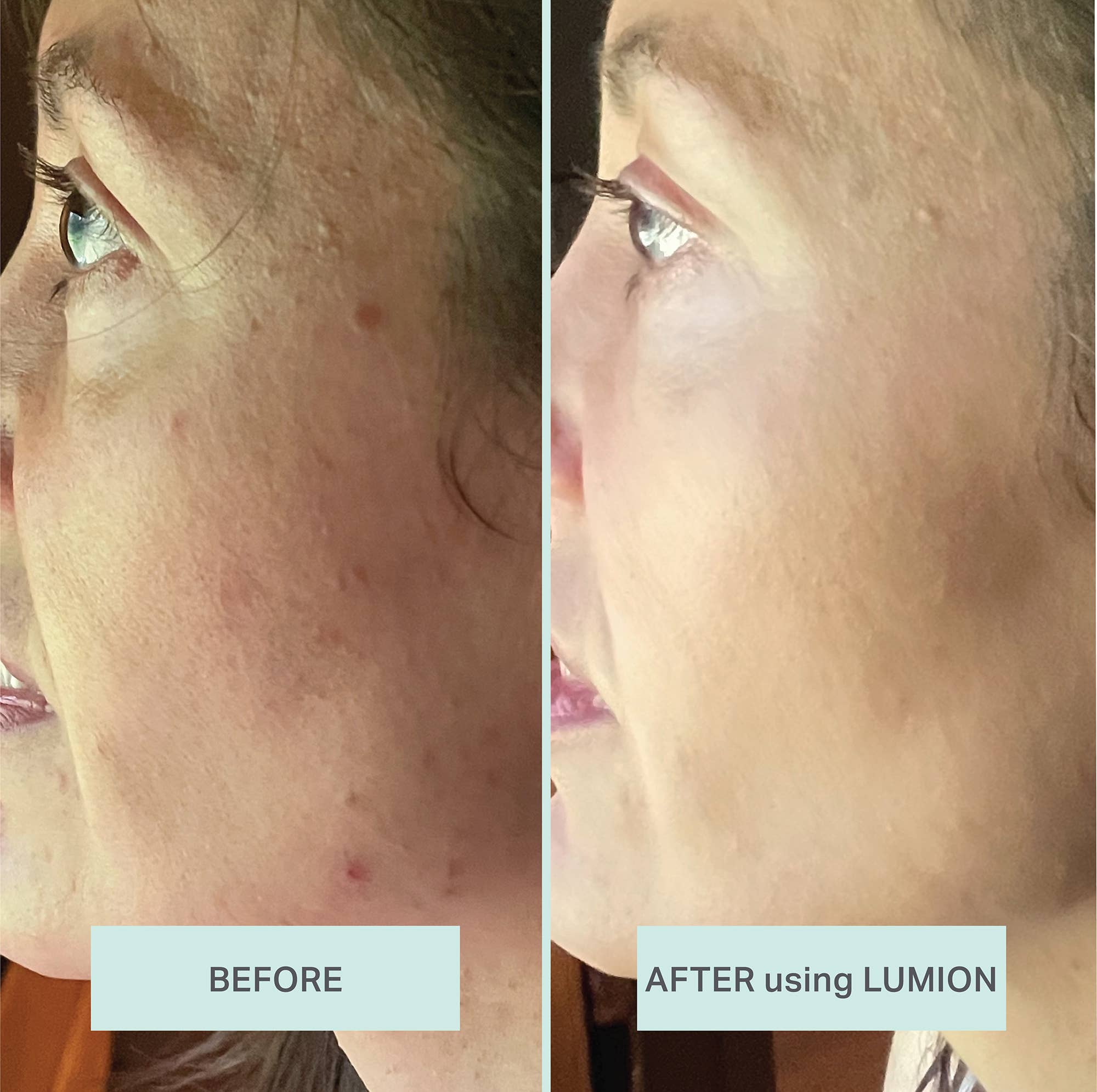 Miracle Mist Refill with HOCl + Oxygen